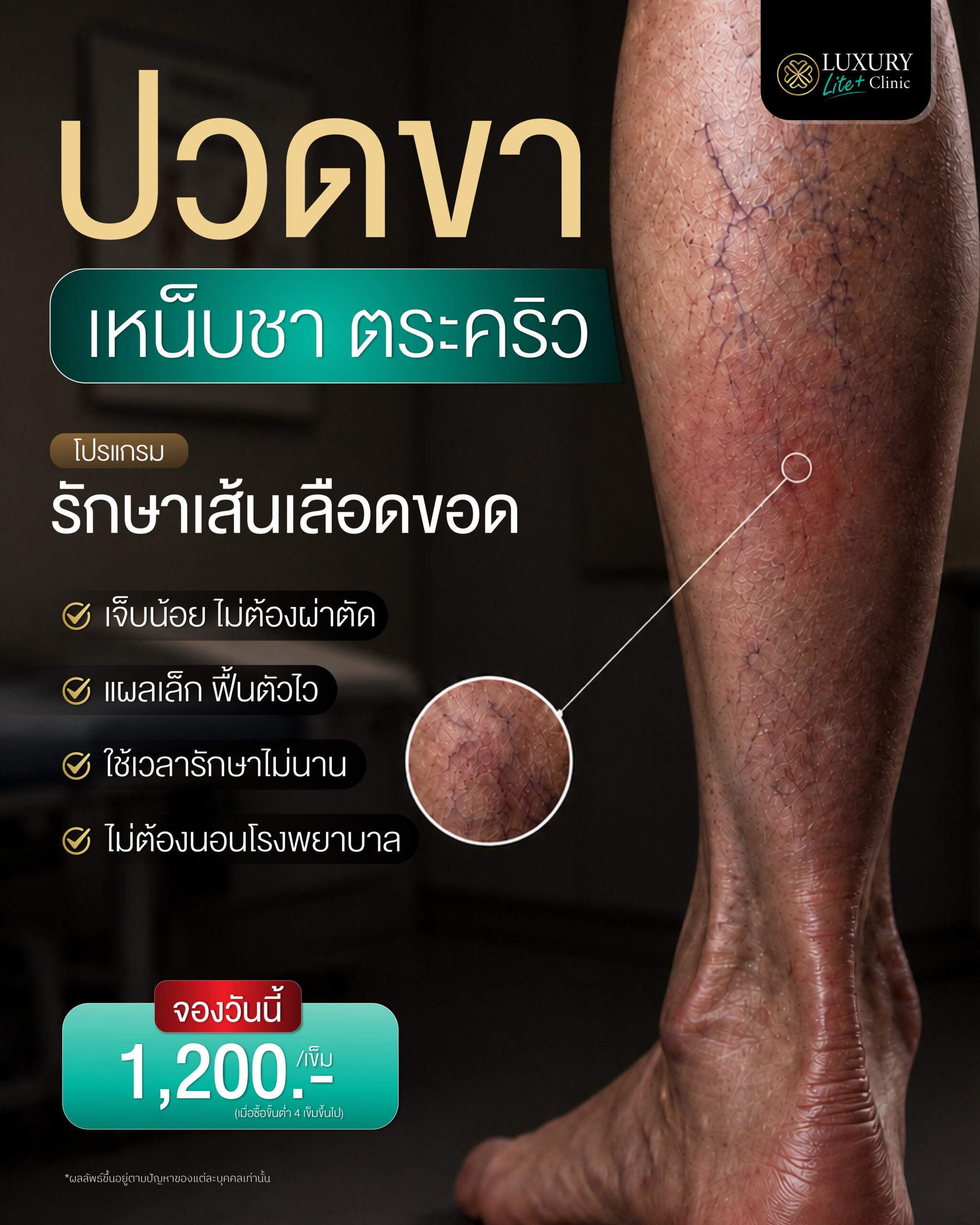 TG_BRIEF_FF_เส้นขอด-02